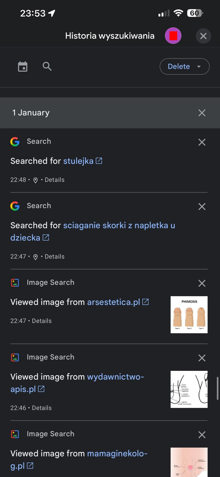 Zrzut ekranu przedstawiający historię wyszukiwania. Informacje na temat stulejki i medyczne ilustracje w tym temacie.
